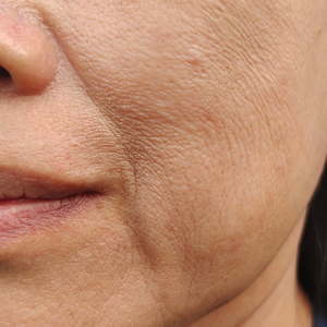 ANTI-AGEING